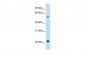 SLC17A5 antibody - N-terminal region